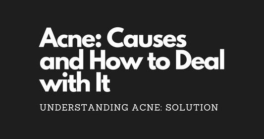 Understanding Acne: Causes and How to Deal with It